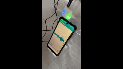 electromiografia de superficie en fonoaudiologia