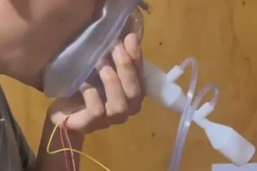 terapia de nodulos en Castro chiloe