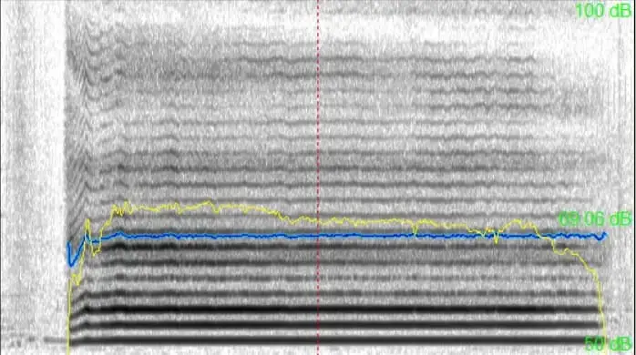 Disfonia nodulos polipos fonoaudiologo de voz