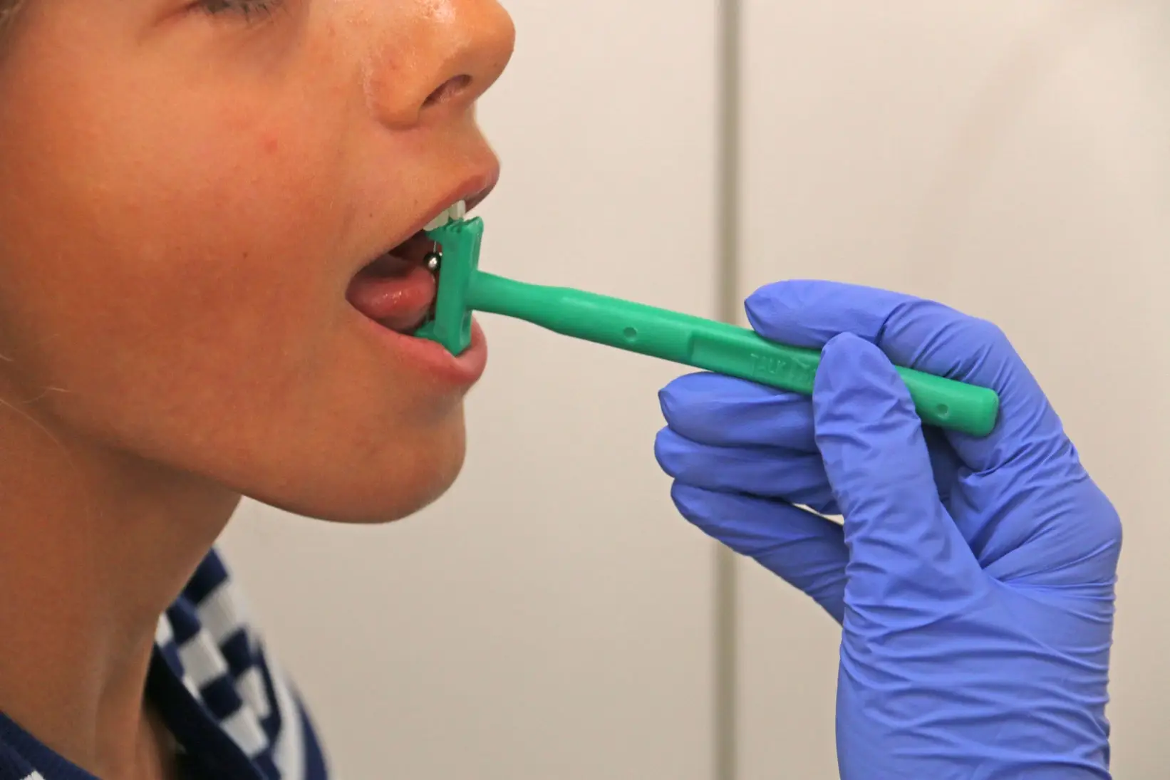 terapia deglucion atipica en castro chiloe dalcahue chonchi